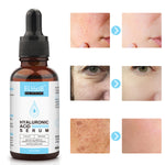 ELBBUB Hyaluronic Acid Face Serum, 30ml