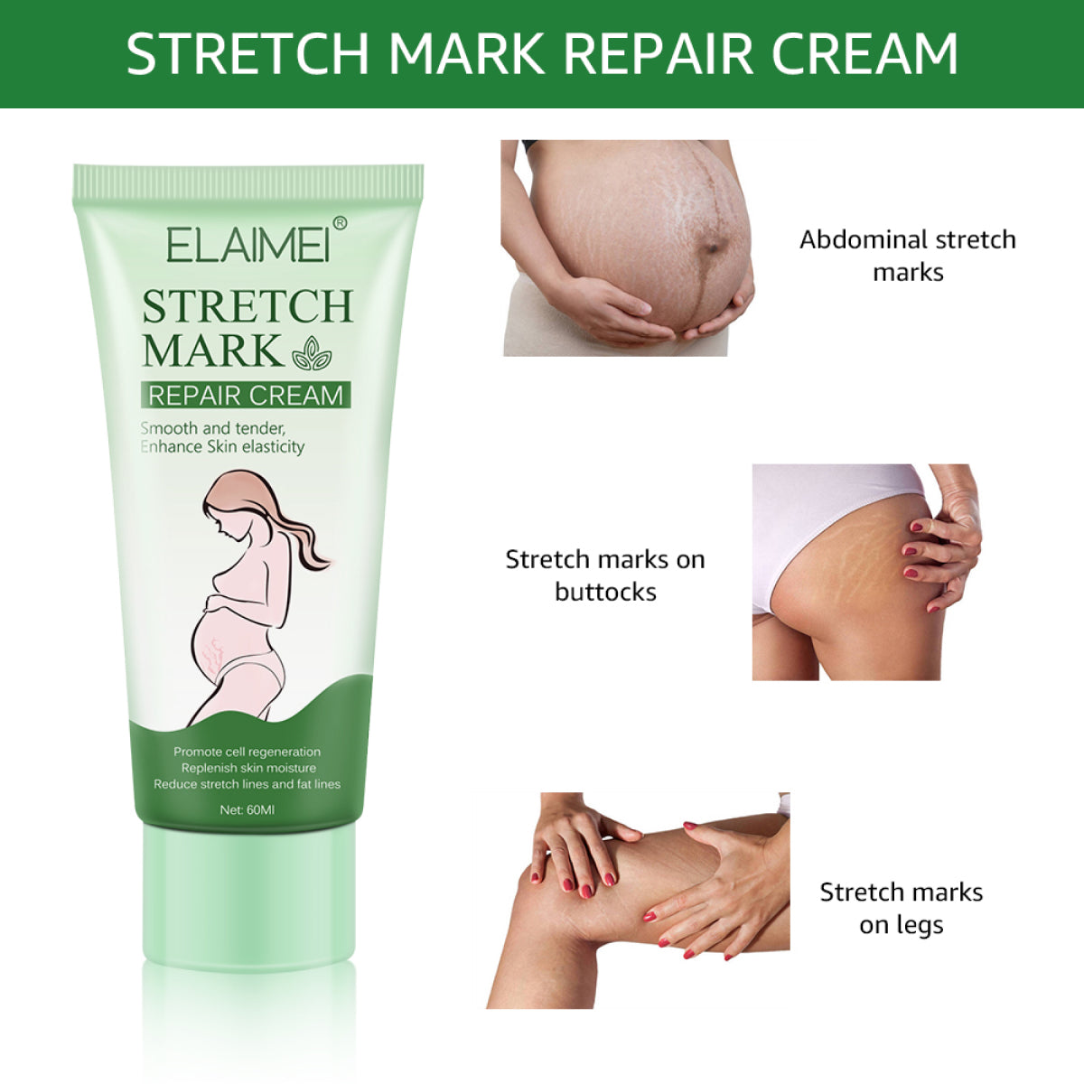 ELAIMEI Anti Stretch Mark Cream, 60ml