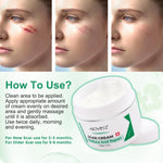 Aliver Treatment Scar Remove Cream for Body Face Skin
