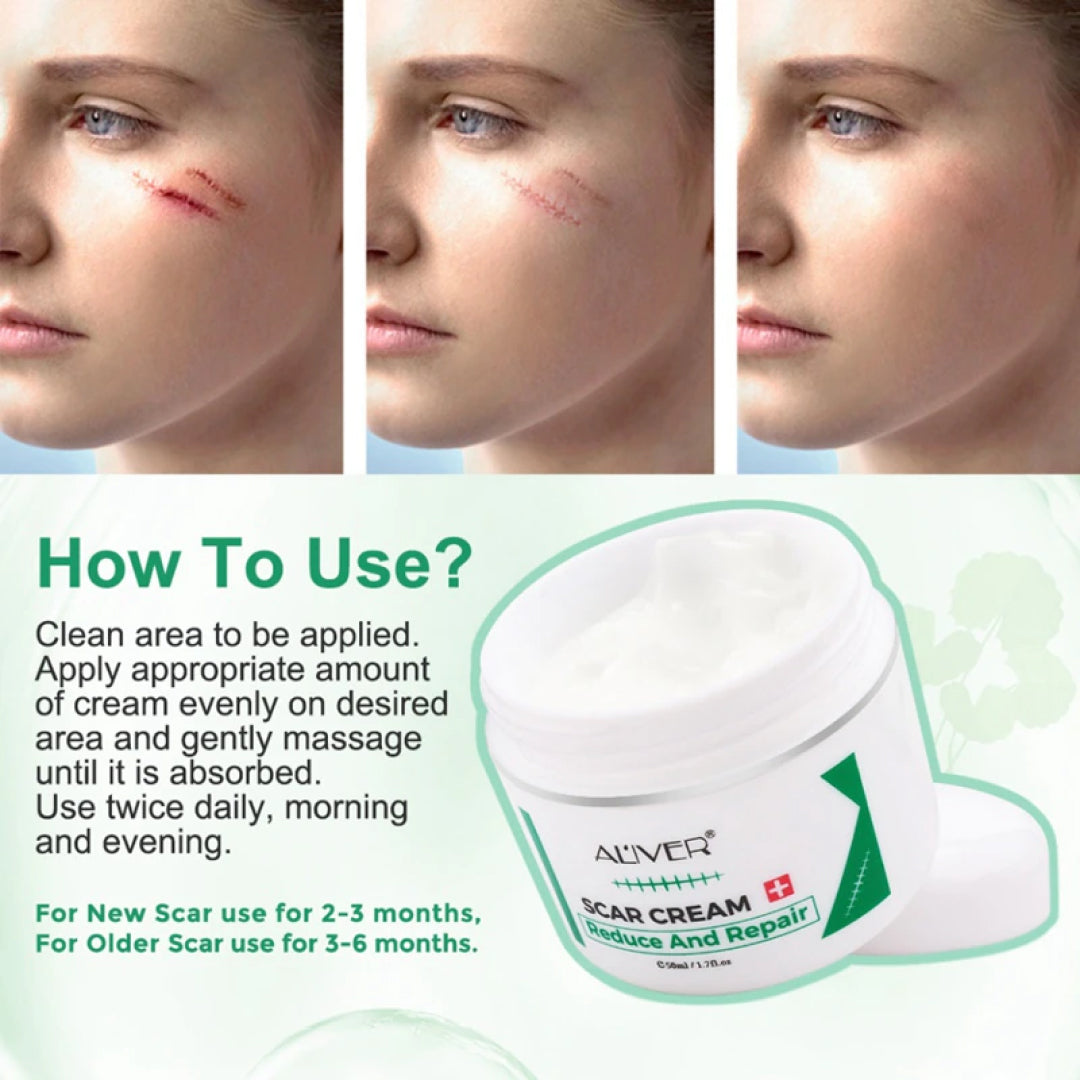 Aliver Treatment Scar Remove Cream for Body Face Skin