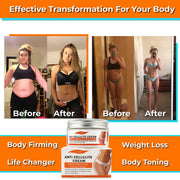 ELAIMEI Anti Cellulite Body Cream, 100g