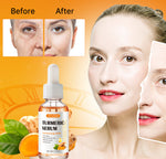 SEFUDUN Turmeric Serum for Dark Spots, 30ml