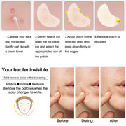 ELAIMEI Acne Pimple Patches for Face, 20pcs