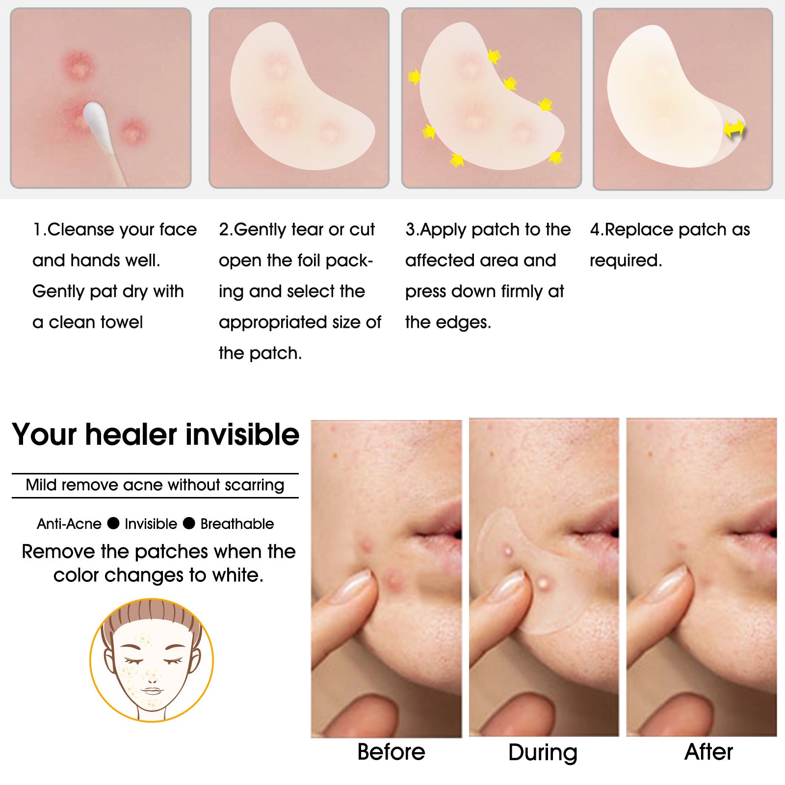 ELAIMEI Acne Pimple Patches for Face, 20pcs