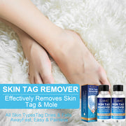 ELAIMEI Skin Tag Remover, Wart & Mole Body Liquid, 30ml