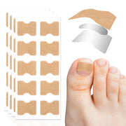 SEFUDUN Toenail Correction Stickers, pack of 100pcs
