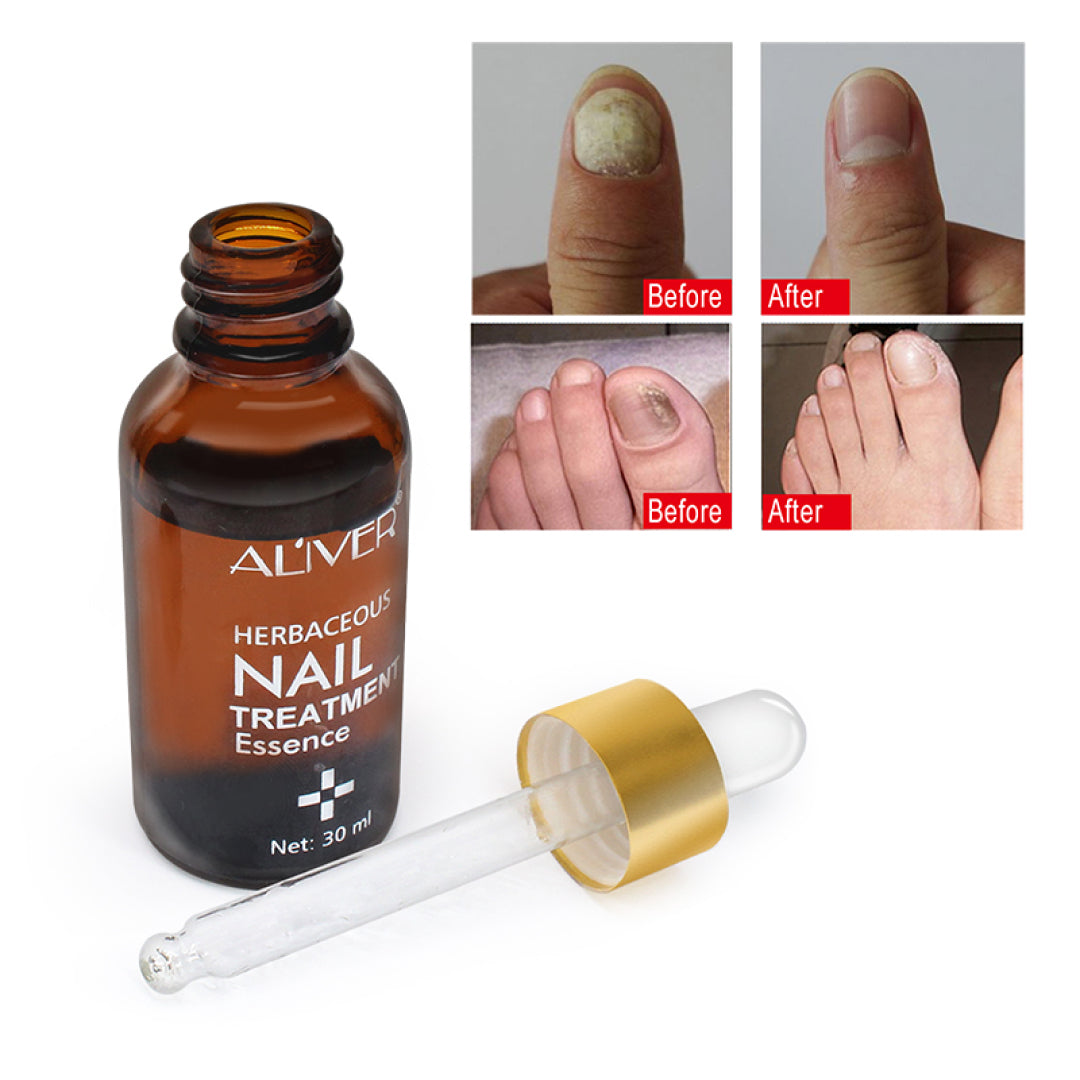 Aliver Fungus Nail Anti Fungal Infection Oil Treatment