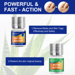 ALIVER 2in1 Effective Body Skin Tag Mole & Wart Removal Kit