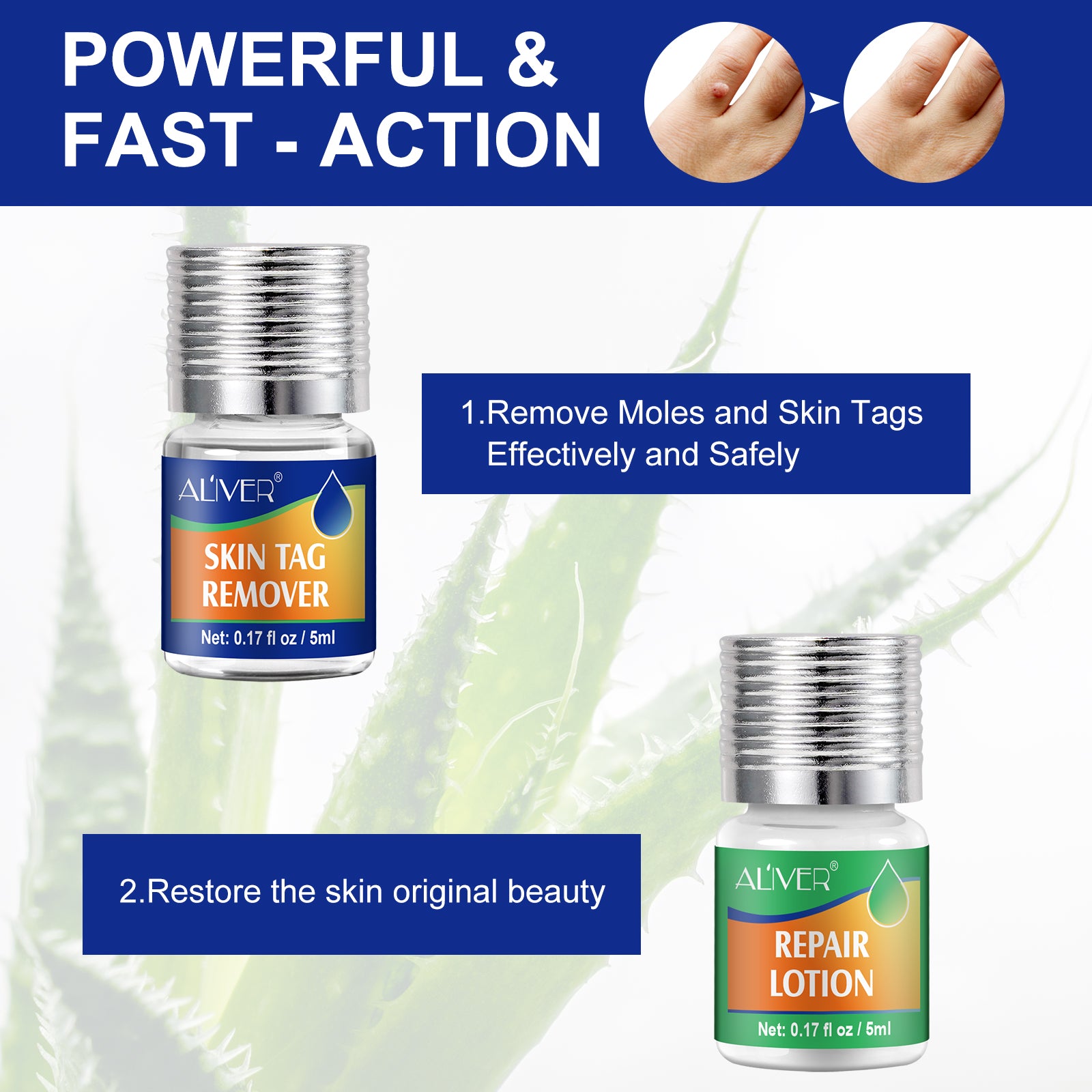 ALIVER 2in1 Effective Body Skin Tag Mole & Wart Removal Kit