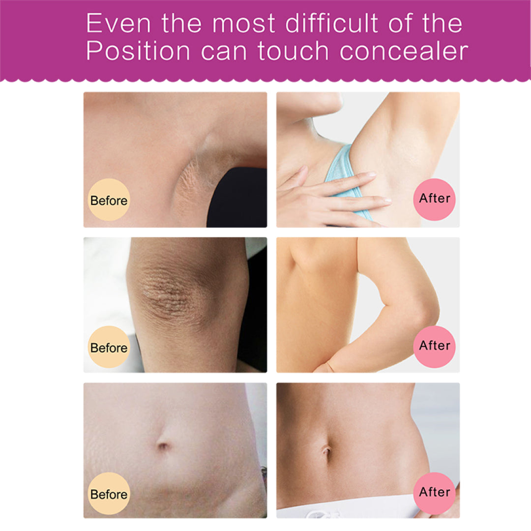 Elaimei Dark Skin Whitening Cream for Lightening Body Areas