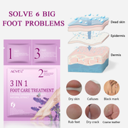 ALIVER 3in1 Exfoliating Foot Care Treatment Kit Peeling Mask