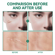 ELAIMEI Advanced Scar Removal Gel for Body, 50ml