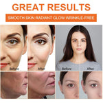 IFUDOIT 20% Vitamin C Serum for Face Skin Moisturizer 30ml