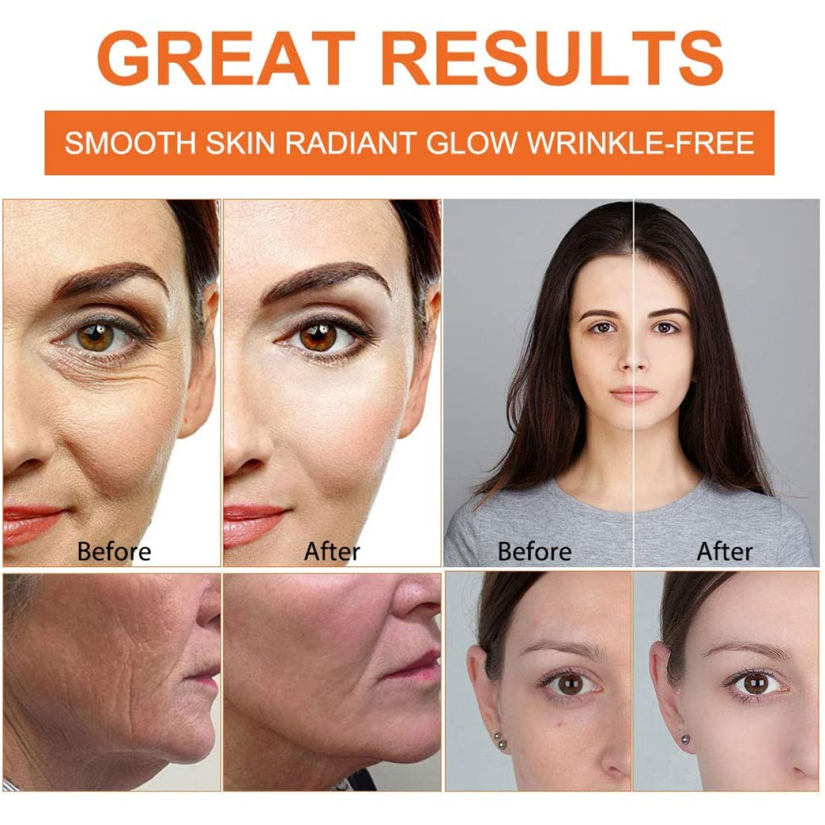 IFUDOIT 20% Vitamin C Serum for Face Skin Moisturizer 30ml