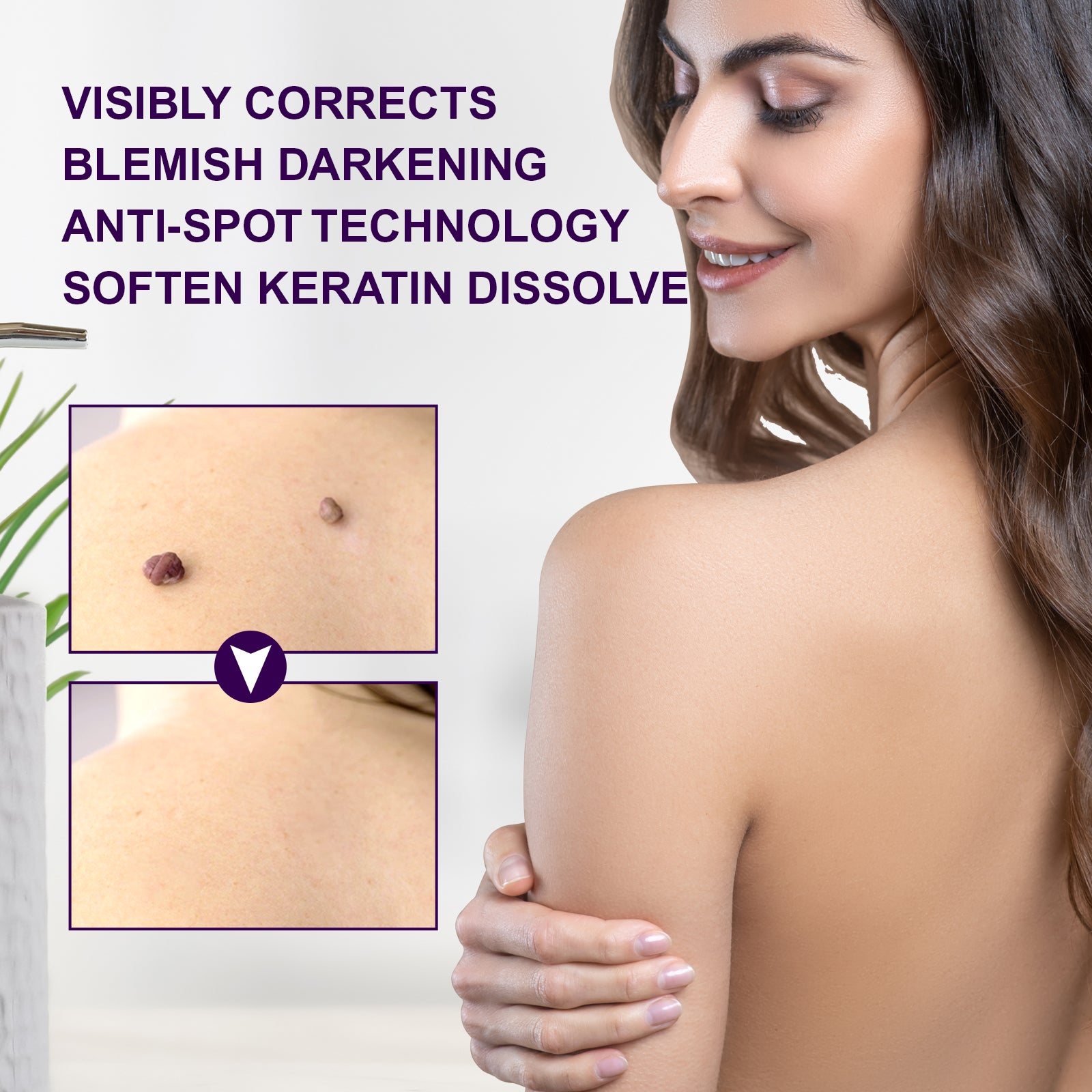 ALIVER Safe Skin Tag Removal Liquid, 30ml