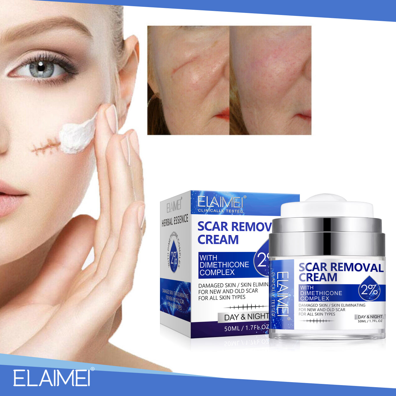 ELAIMEI Advanced Scar Removal Cream, Day & Night 50ml