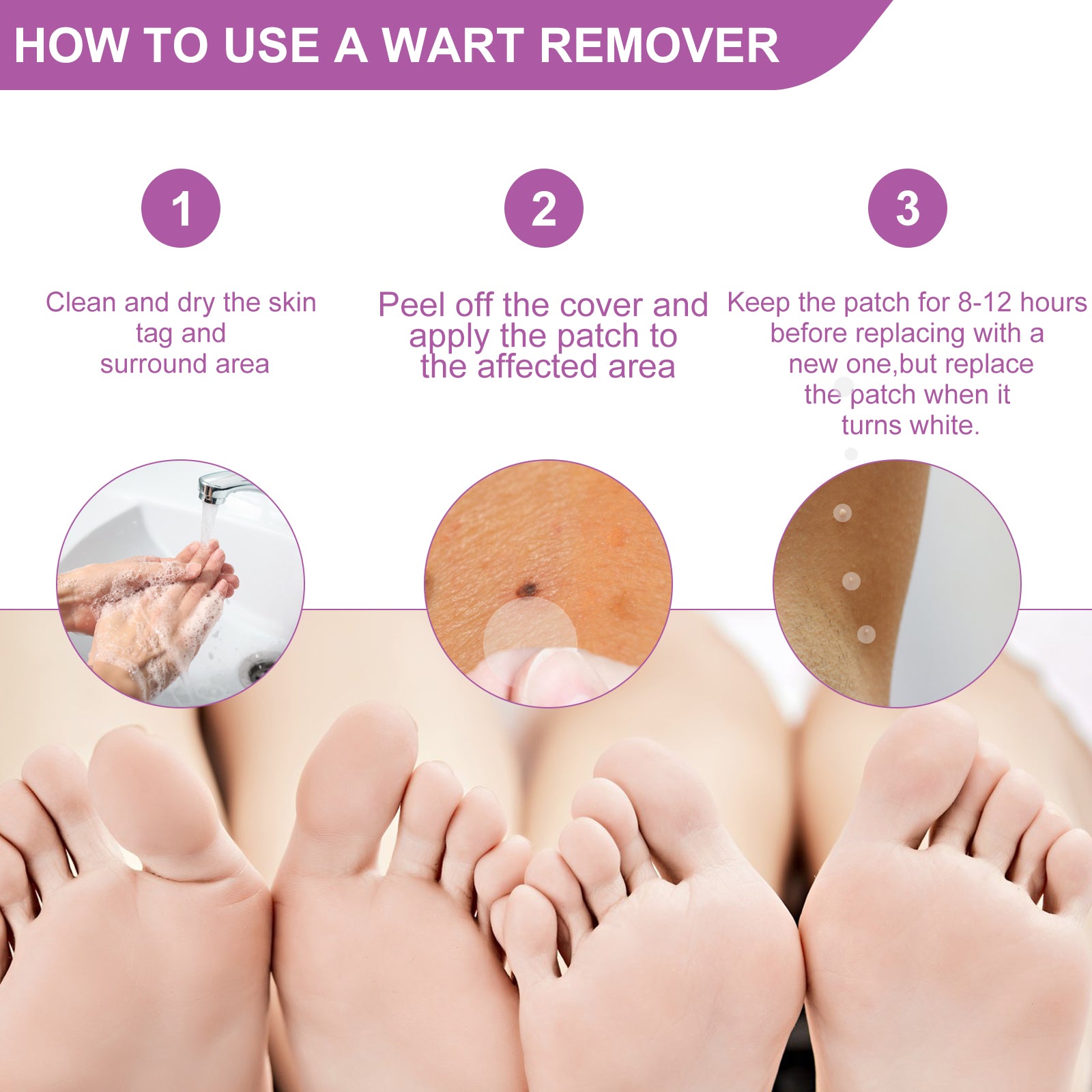 ELAIMEI Skin Tag, Acne & Wart Remover Patches, pack of 144pcs