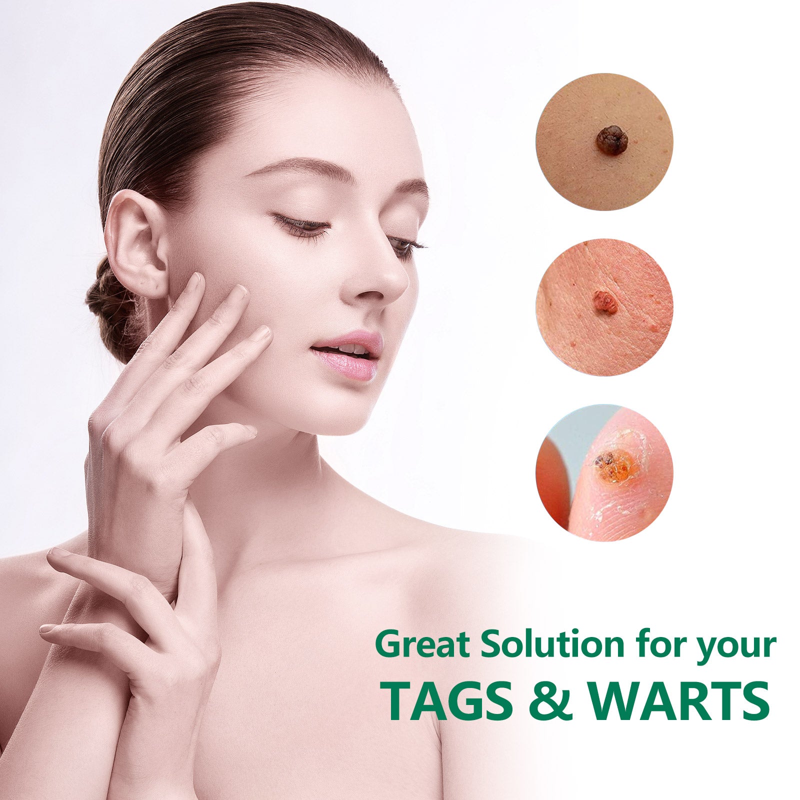 ELAIMEI Natural Herbal Skin Tag Remover Cream, 100g