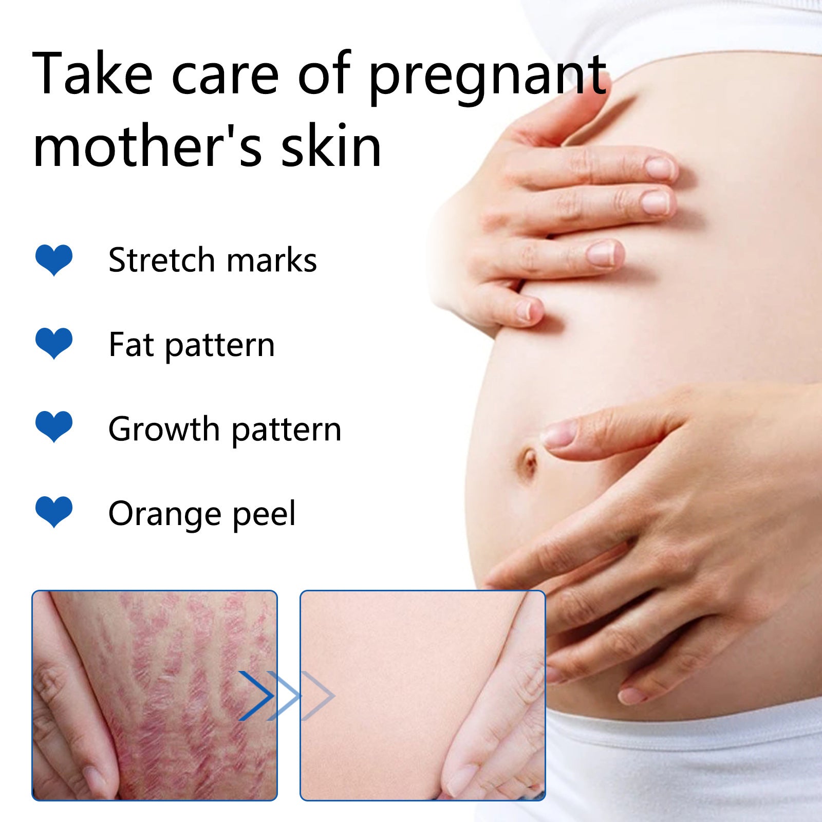 SEFUDUN Anti Stretch Mark Essential Oil, 30ml