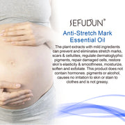 SEFUDUN Anti Stretch Mark Essential Oil, 30ml