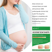 ALIVER Silicone Scar Sheets, Reduction Treatment, pack of 4pcs
