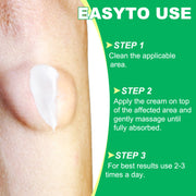 SEFUDUN Lipoma Removal Cream, 20g