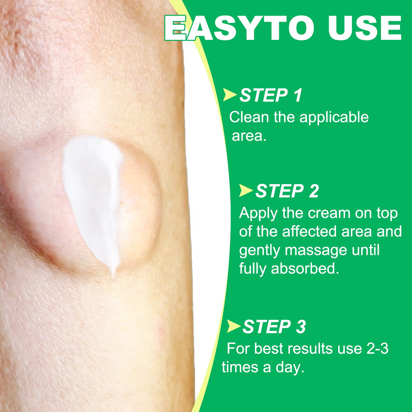 SEFUDUN Lipoma Removal Cream, 20g