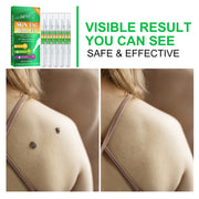 ALIVER Body Skin Tag Remover Pens, Anti Mole & Wart Kit, 5pcs