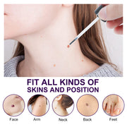 ALIVER Safe Skin Tag Removal Liquid, 30ml