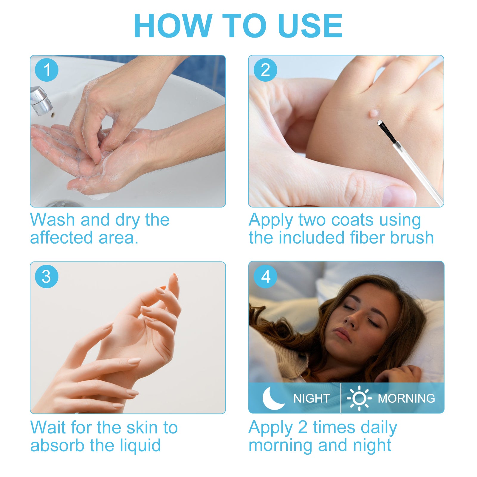 ELAIMEI Skin Tag Remover, Wart & Mole Body Liquid, 30ml