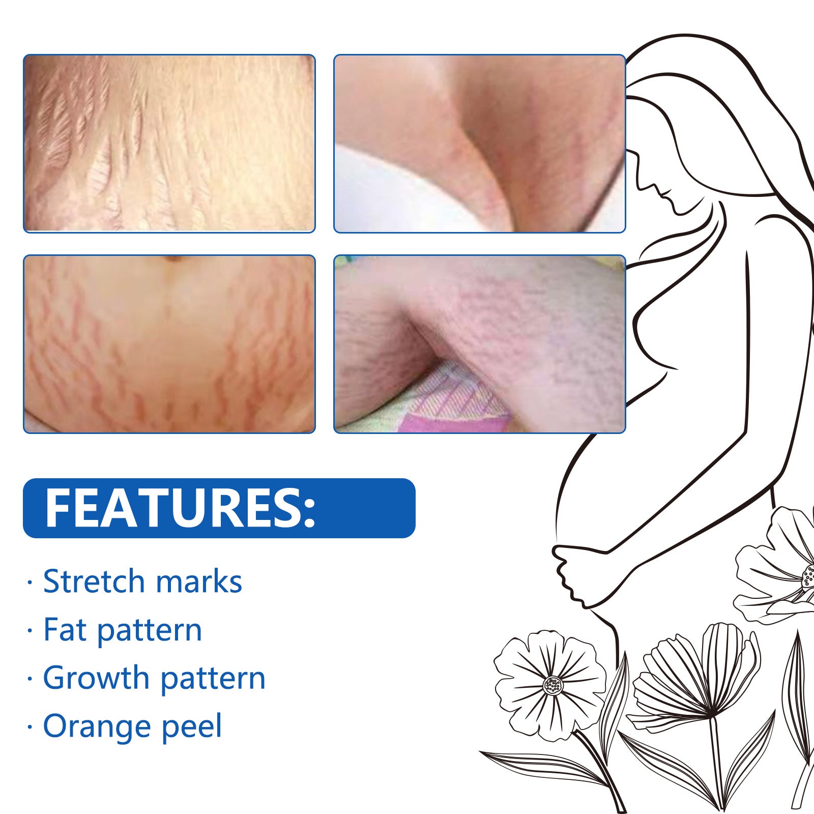 SEFUDUN Anti Stretch Mark Essential Oil, 30ml