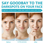 ELAIMEI Dark Spot Corrector, Whitening Cream 50ml