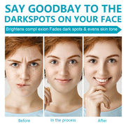 ELAIMEI Dark Spot Corrector, Whitening Cream 50ml