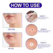 ALIVER Safe Skin Tag Remover Patches, pack of 180pcs