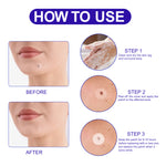 ALIVER Safe Skin Tag Remover Patches, pack of 180pcs