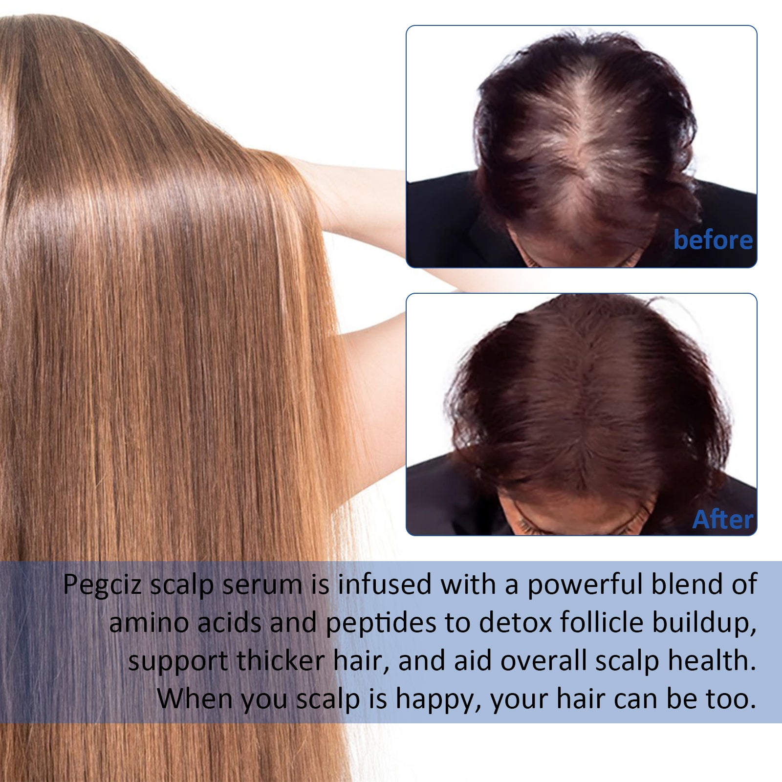PEGCIZ Scalp Serum for Hair Growth, 30ml