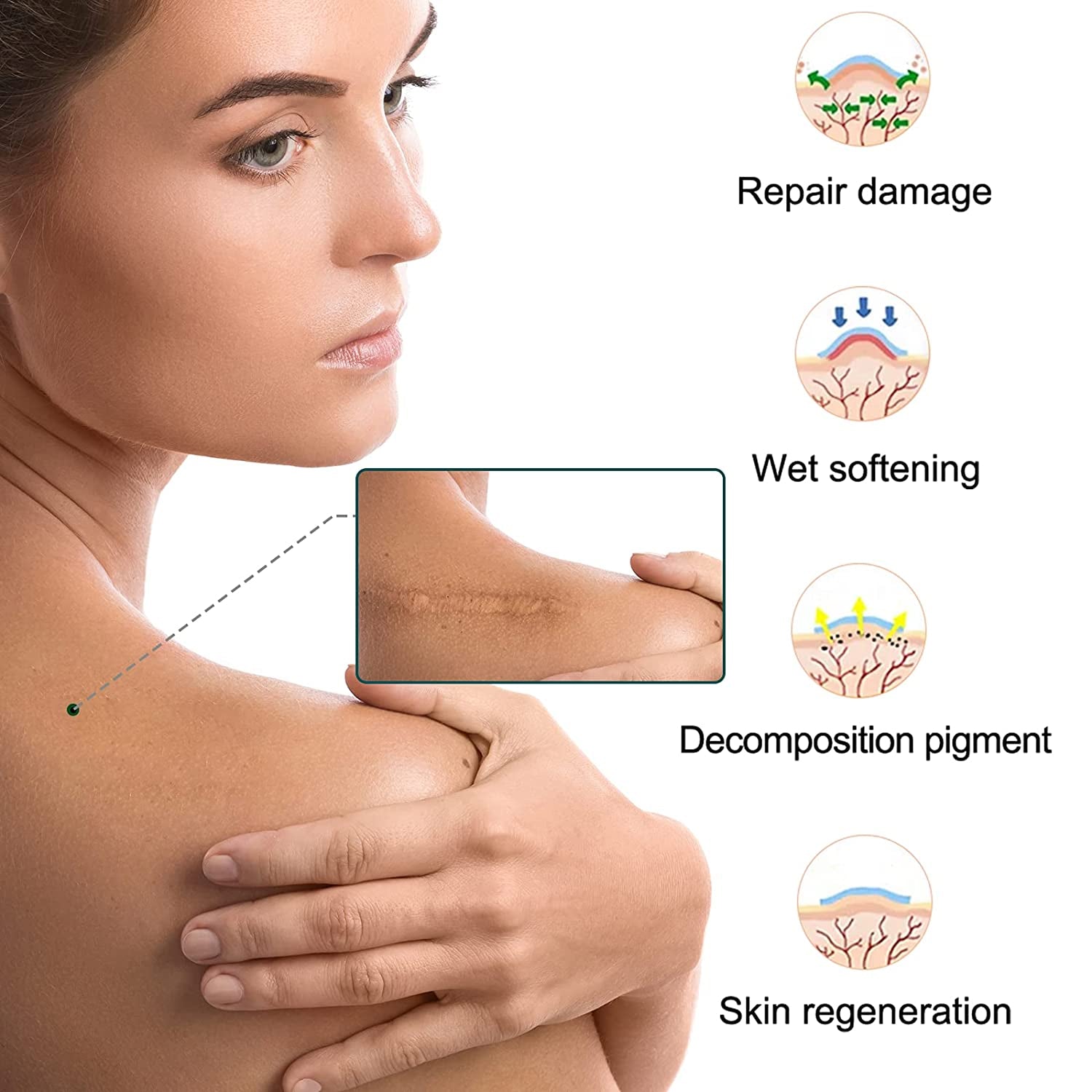 ELAIMEI Silicone Scar Removal Sheets, Roll Tape 3m