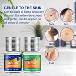 ALIVER 2in1 Effective Body Skin Tag Mole & Wart Removal Kit