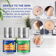 ALIVER 2in1 Effective Body Skin Tag Mole & Wart Removal Kit