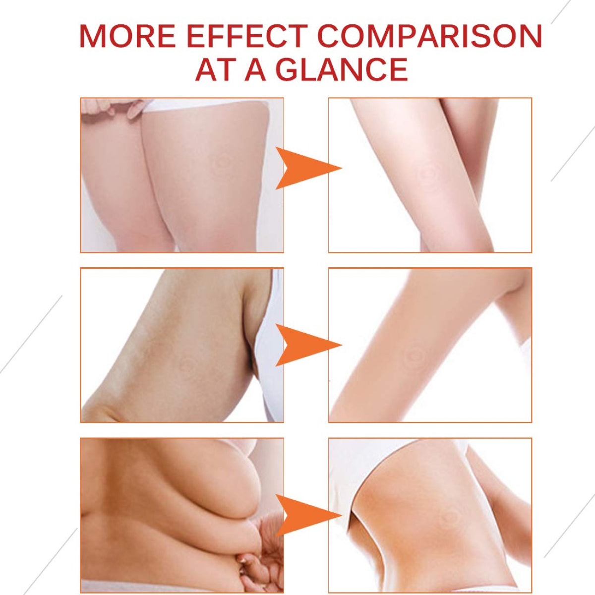 ELAIMEI Anti Cellulite Body Cream, 100g