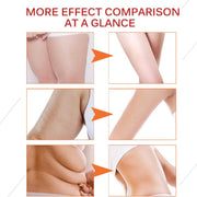 ELAIMEI Anti Cellulite Body Cream, 100g