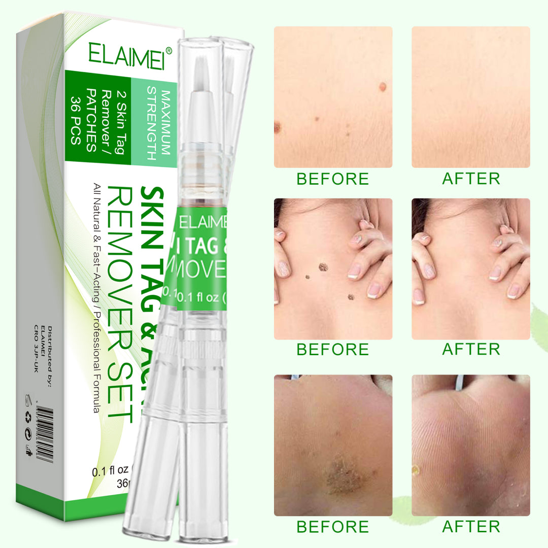 ELAIMEI 2n1 Skin Tag Remover Pens & Anti Acne Patches Set