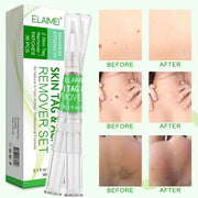 ELAIMEI 2n1 Skin Tag Remover Pens & Anti Acne Patches Set