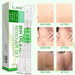 ELAIMEI 2n1 Skin Tag Remover Pens & Anti Acne Patches Set