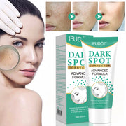 Iffudoit Dark Spot Skin Correcting Cream Remover for Face and Body