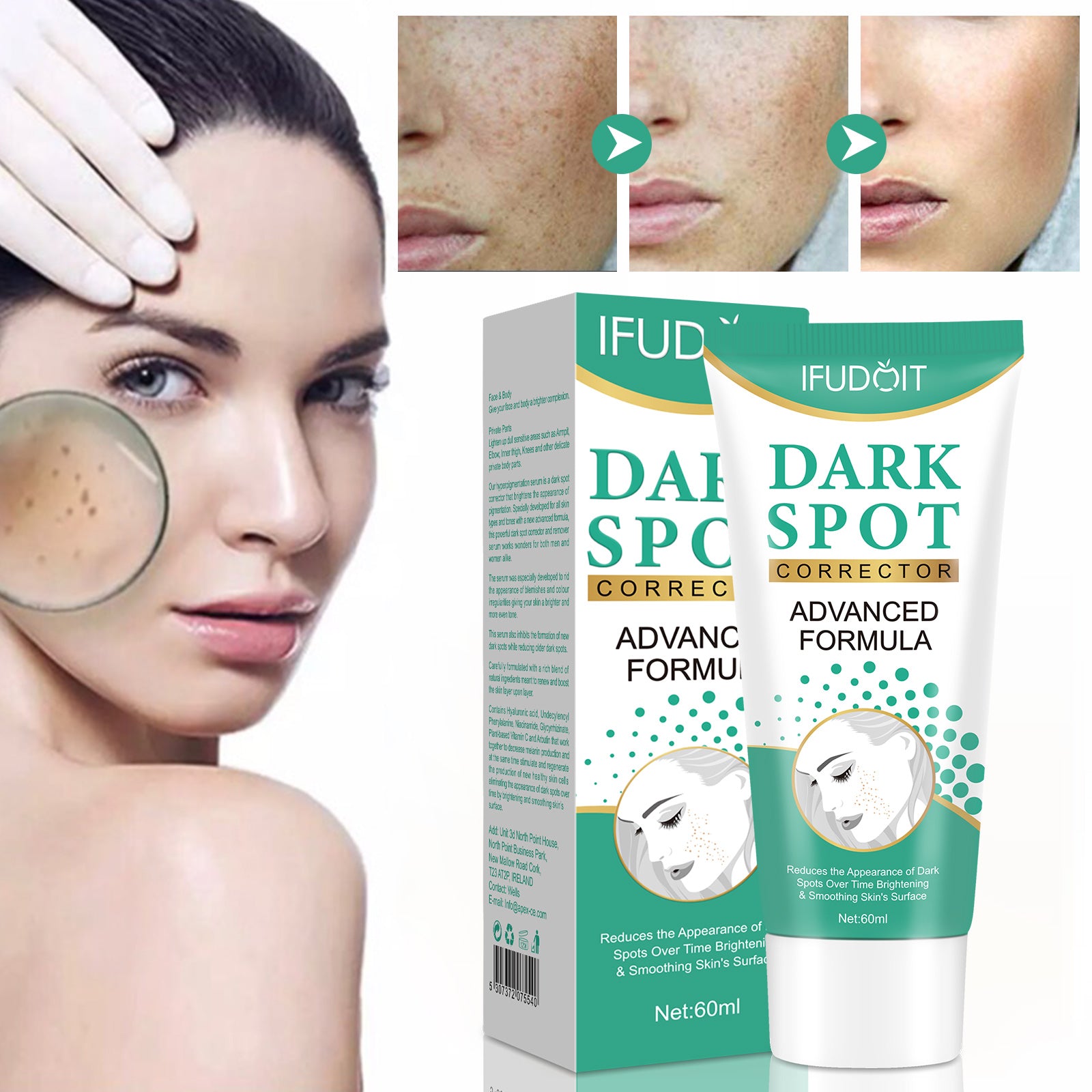 Iffudoit Dark Spot Skin Correcting Cream Remover for Face and Body