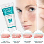 Aliver Dark Spot Remover Corrector Brighter for Face Body Skin Cream