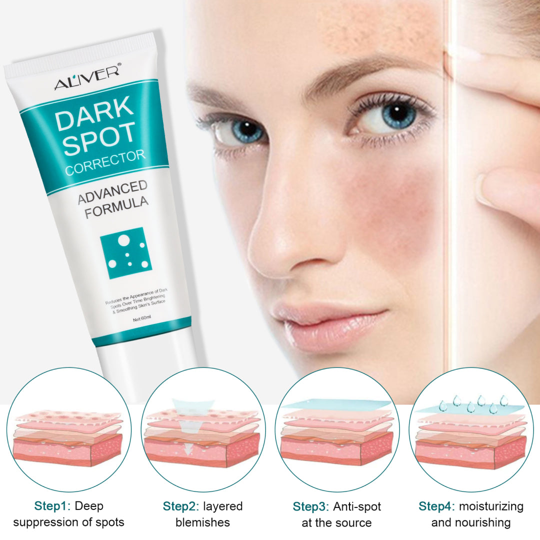 Aliver Dark Spot Remover Corrector Brighter for Face Body Skin Cream