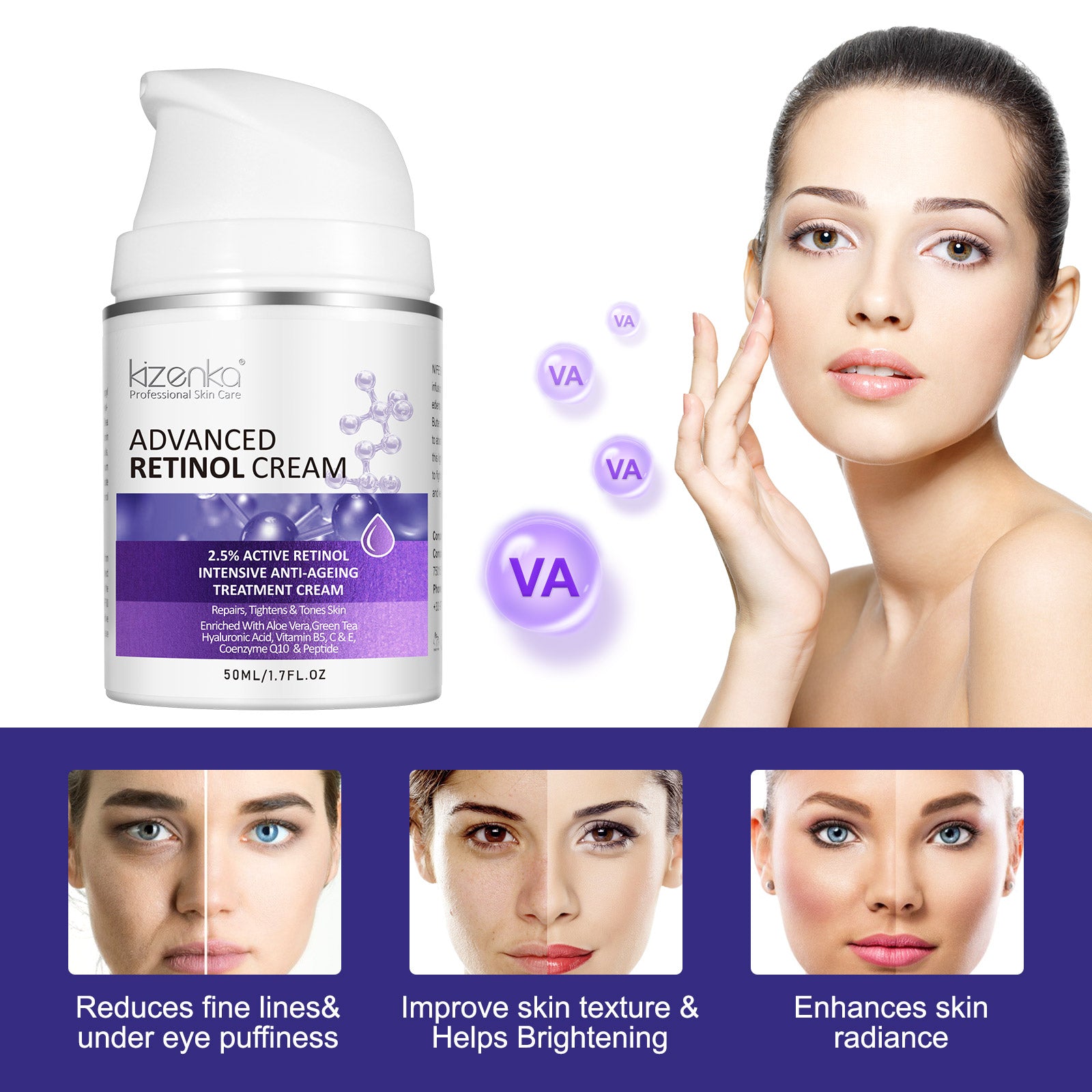 Kizenka Retinol Face Cream Moisturizer Skin Care Anti Aging Wrinkle Acne Treatment Day and Night Cream Dark Spot Remover