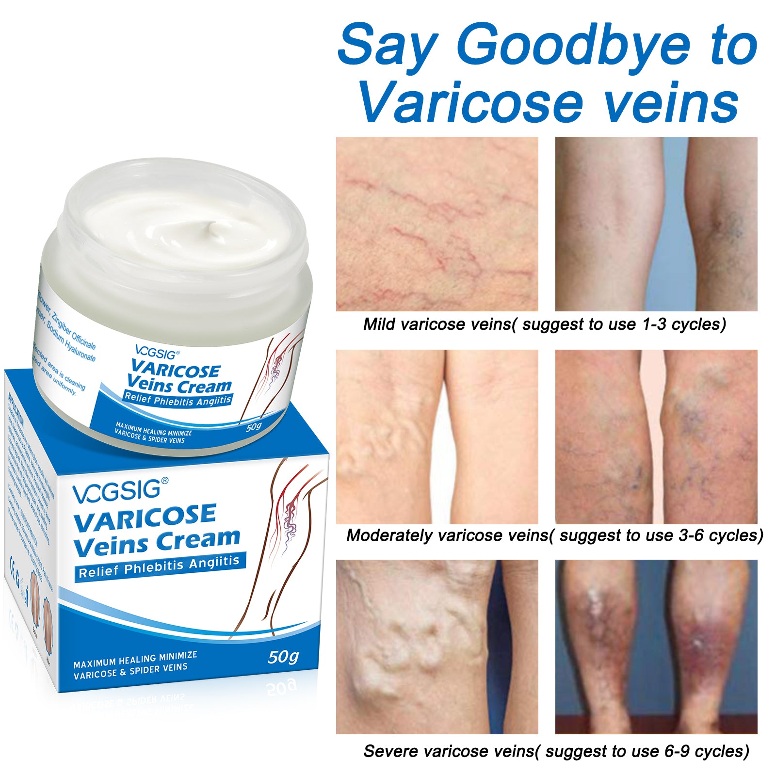 VOGSIG Varicose Veins Cream, 50g